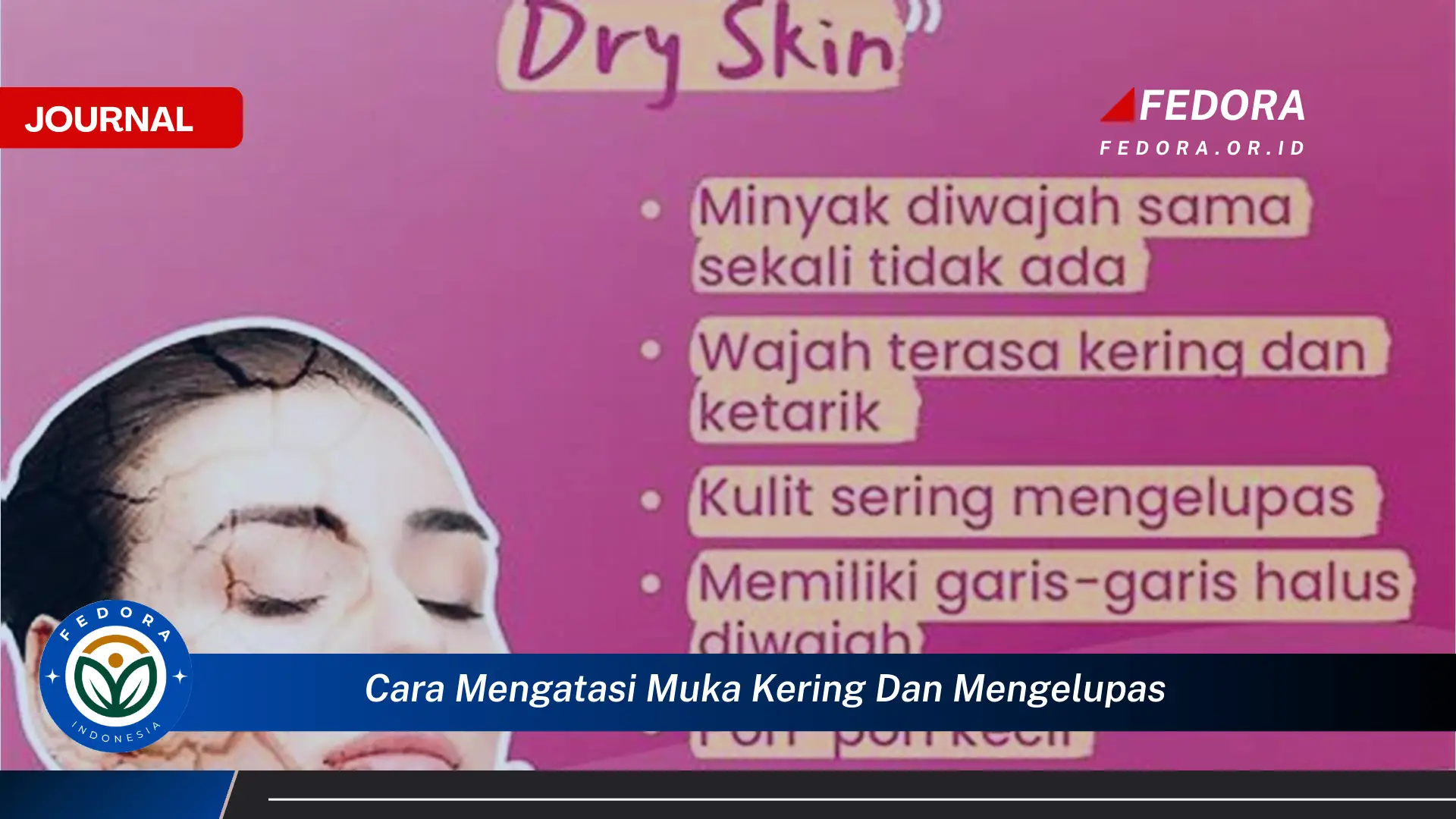 Ketahui Cara Mengatasi Muka Kering dan Mengelupas Secara Efektif dan Alami