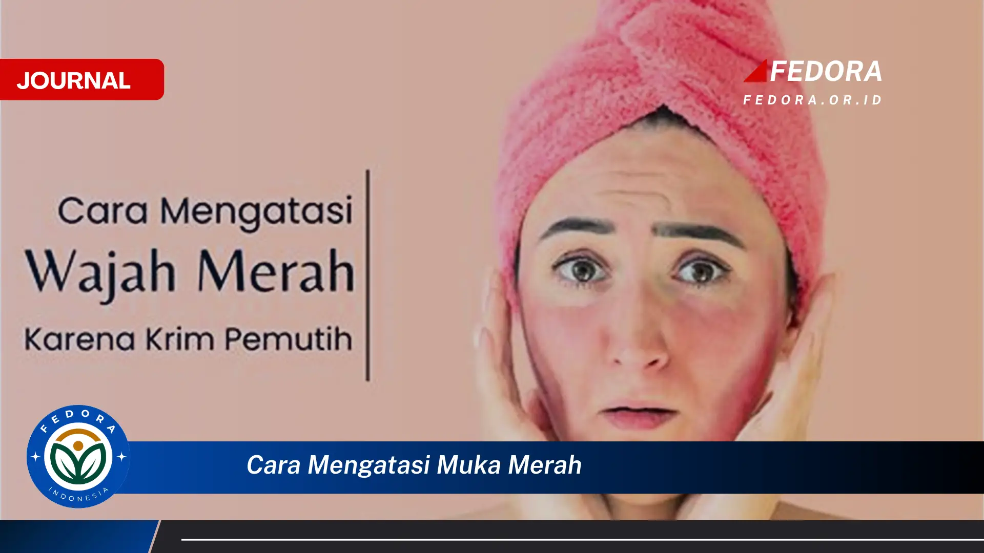 Inilah Cara Mengatasi Muka Merah, Penyebab, Pencegahan, dan Perawatan Efektif