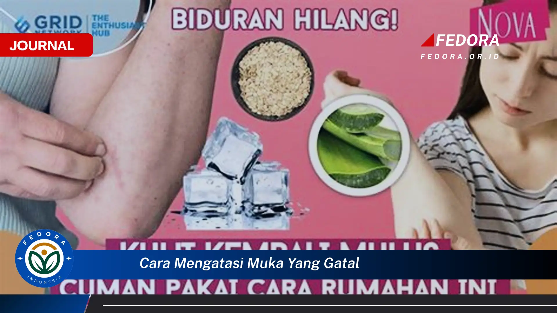 Ketahui Cara Mengatasi Muka Gatal dengan Cepat dan Ampuh