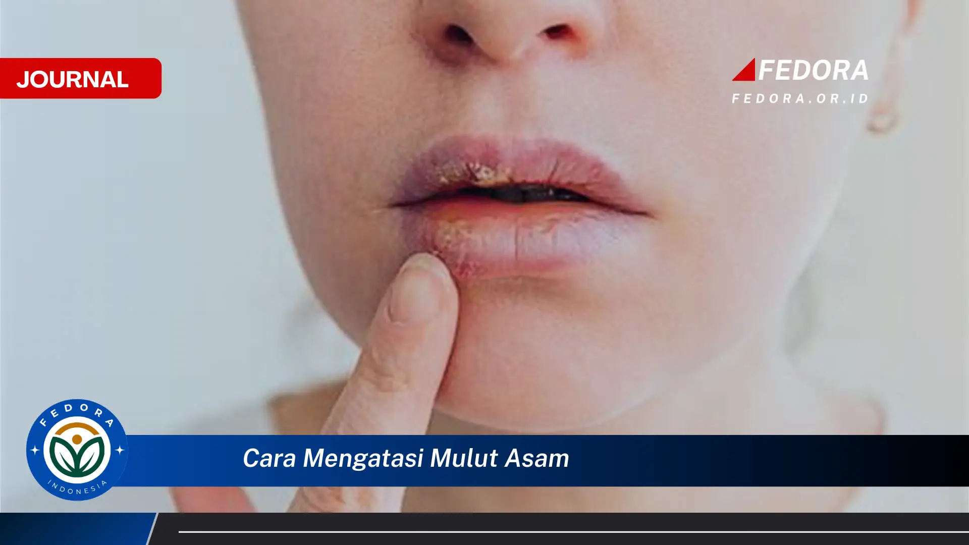 Ketahui Cara Mengatasi Mulut Asam dengan Cepat dan Alami