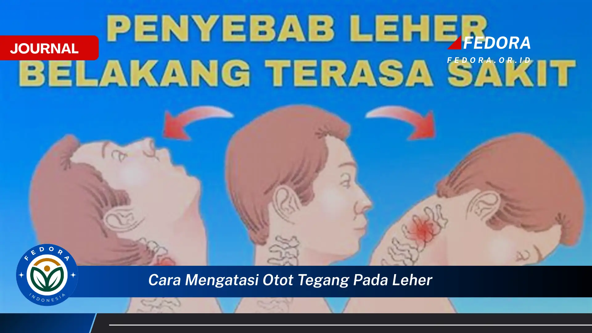 Ketahui Cara Mengatasi Otot Tegang pada Leher Secara Efektif dan Alami