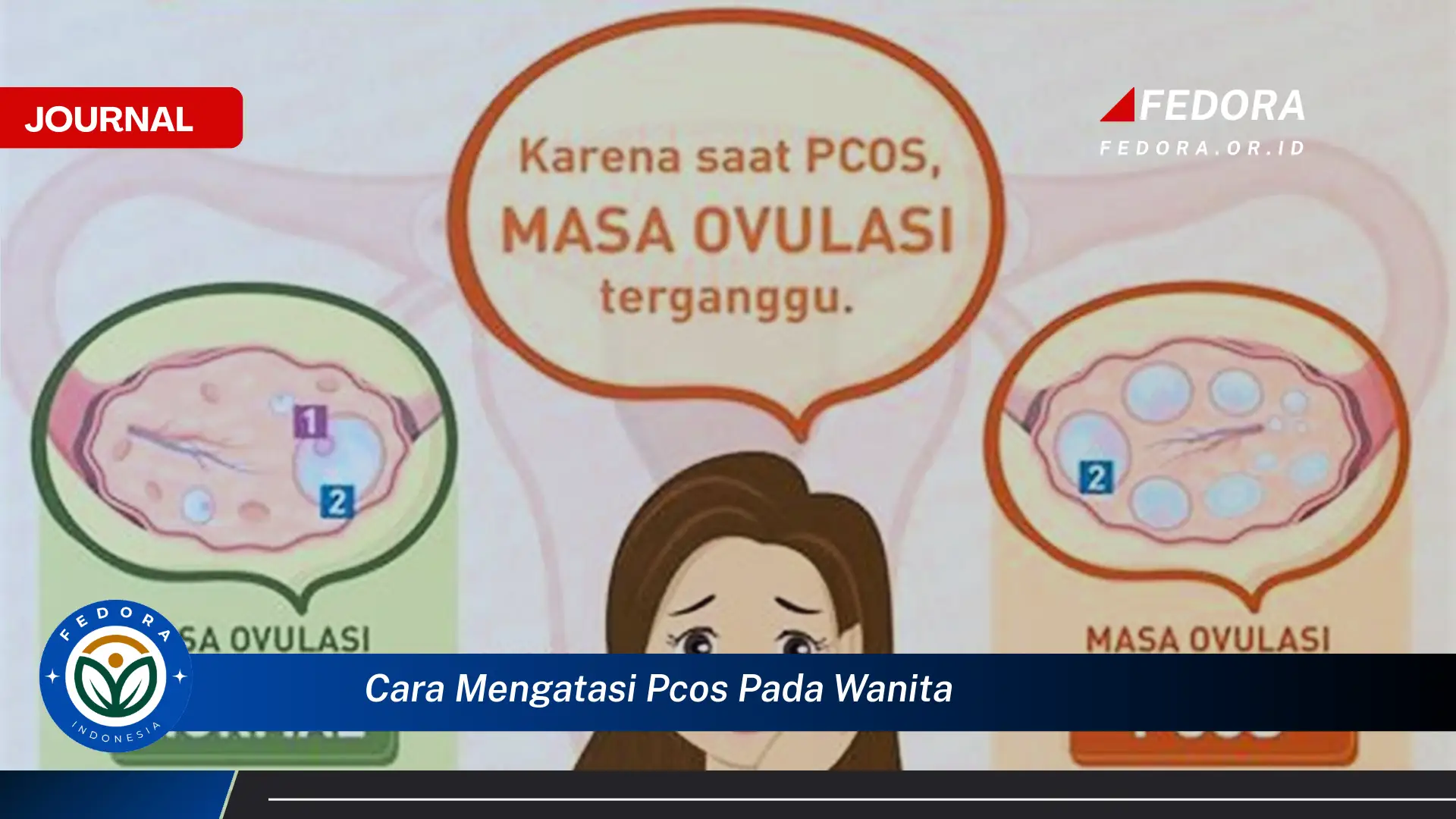 Ketahui Cara Mengatasi PCOS Pada Wanita Secara Alami dan Efektif Ketahui Cara Mengatasi PCOS Pada Wanita Secara Alami dan Efektif