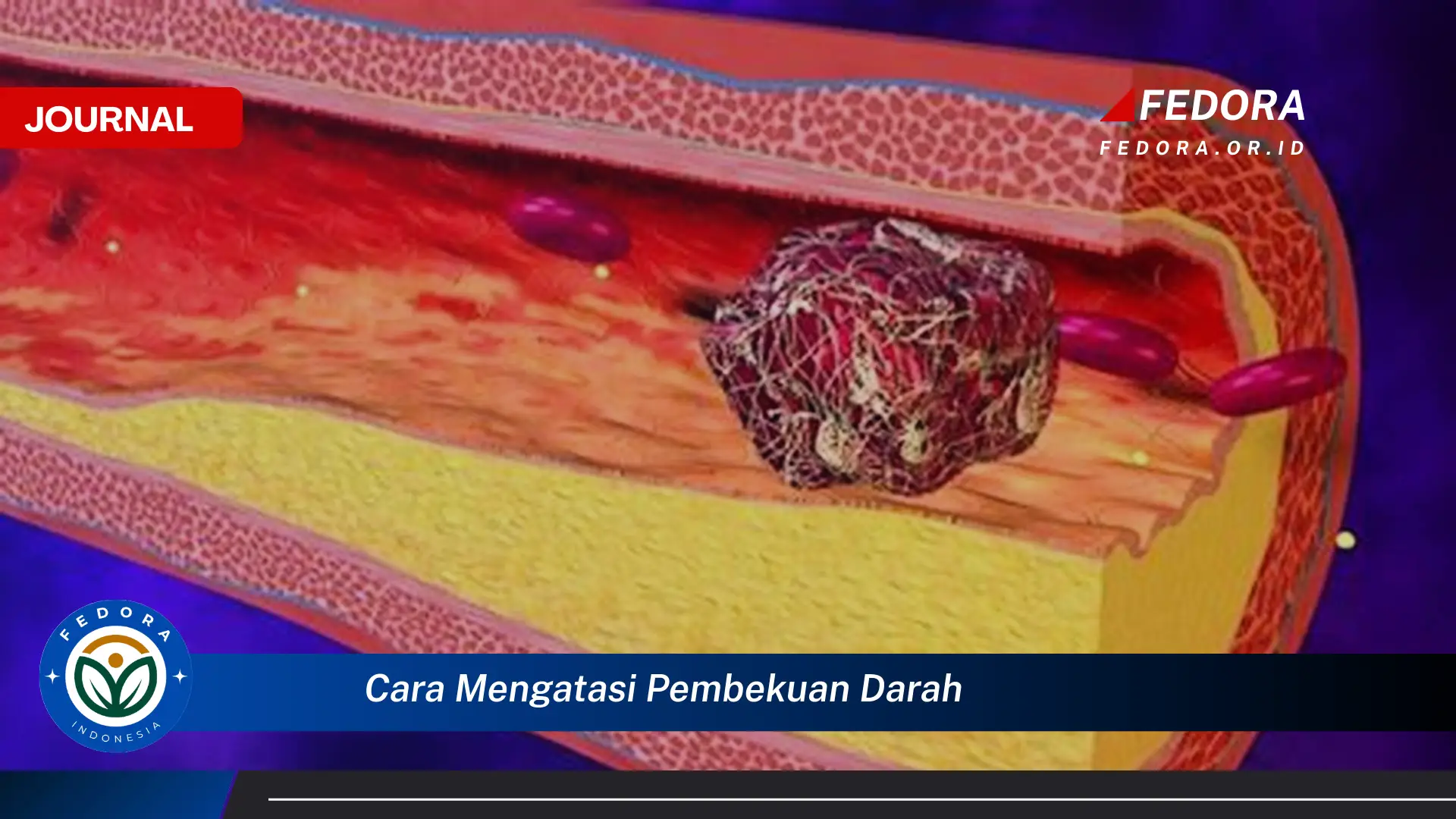 Ketahui Cara Mengatasi Pembekuan Darah Secara Alami dan Medis