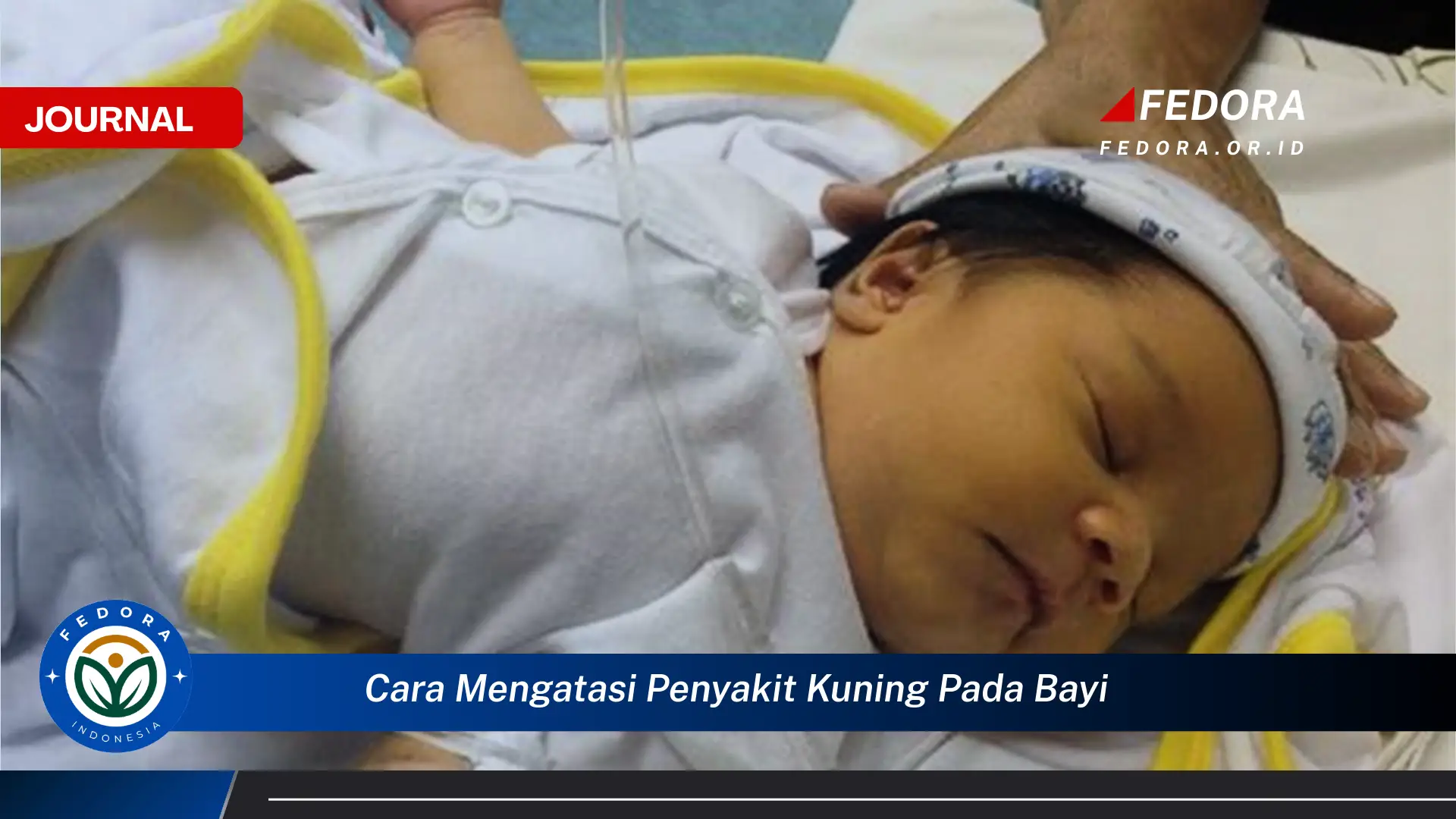 Ketahui Cara Mengatasi Penyakit Kuning pada Bayi Baru Lahir Secara Alami dan Efektif