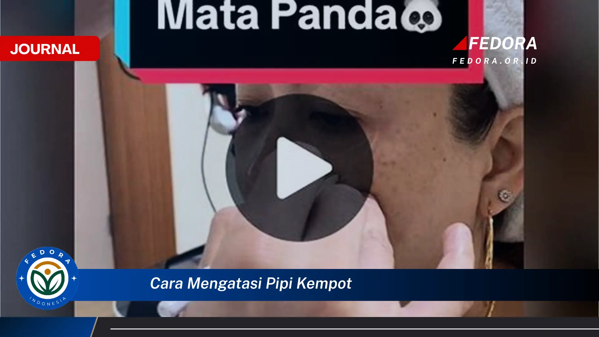 Ketahui Cara Mengatasi Pipi Kempot Secara Alami dan Efektif Ketahui Cara Mengatasi Pipi Kempot Secara Alami dan Efektif