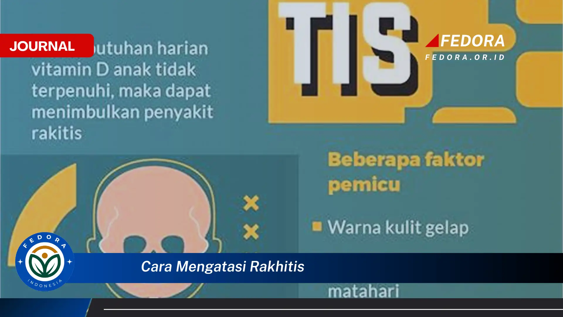 Ketahui Cara Mengatasi Rakhitis pada Anak Secara Efektif dan Alami