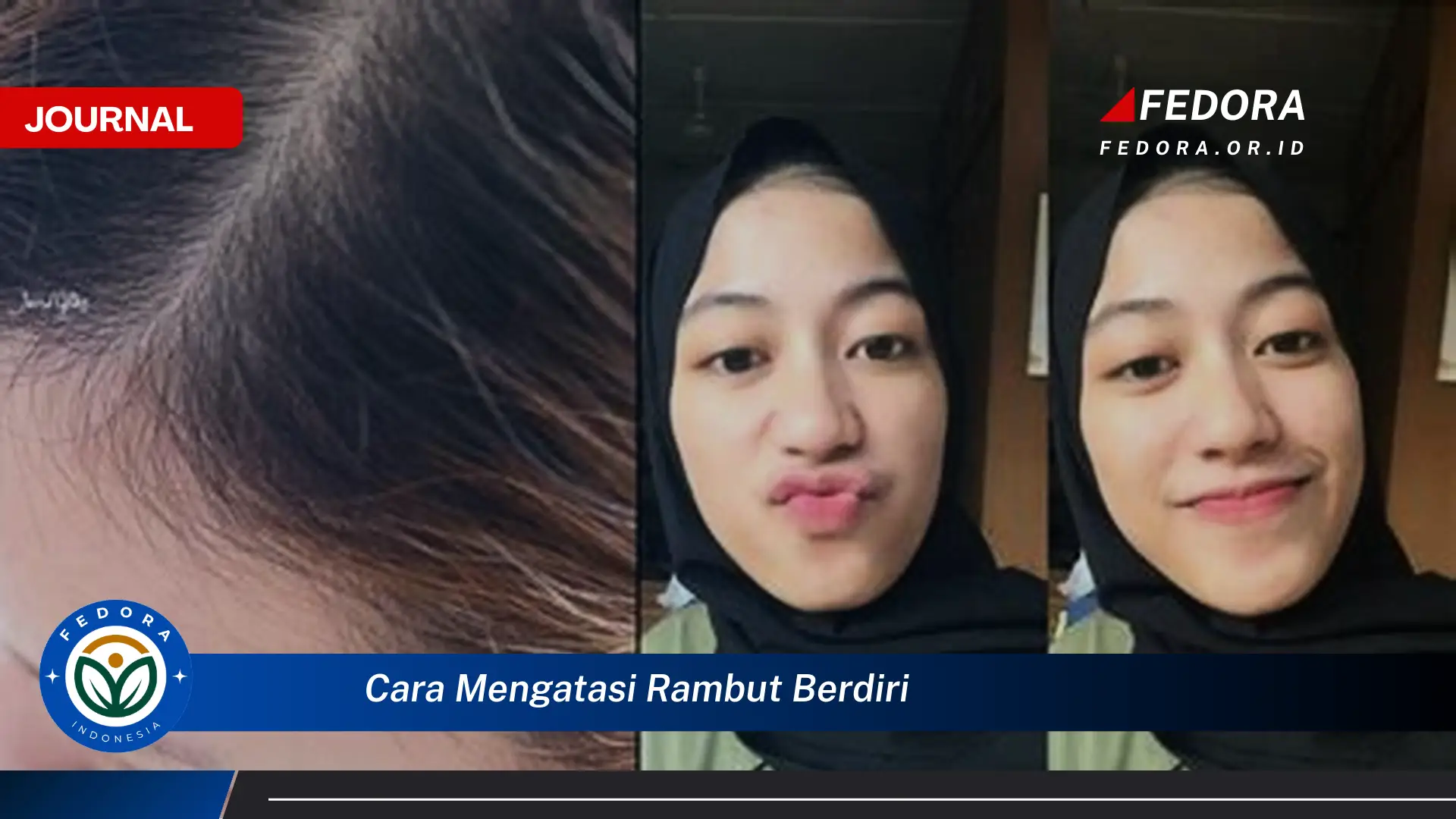 Ketahui Cara Mengatasi Rambut Berdiri dengan Cepat dan Mudah