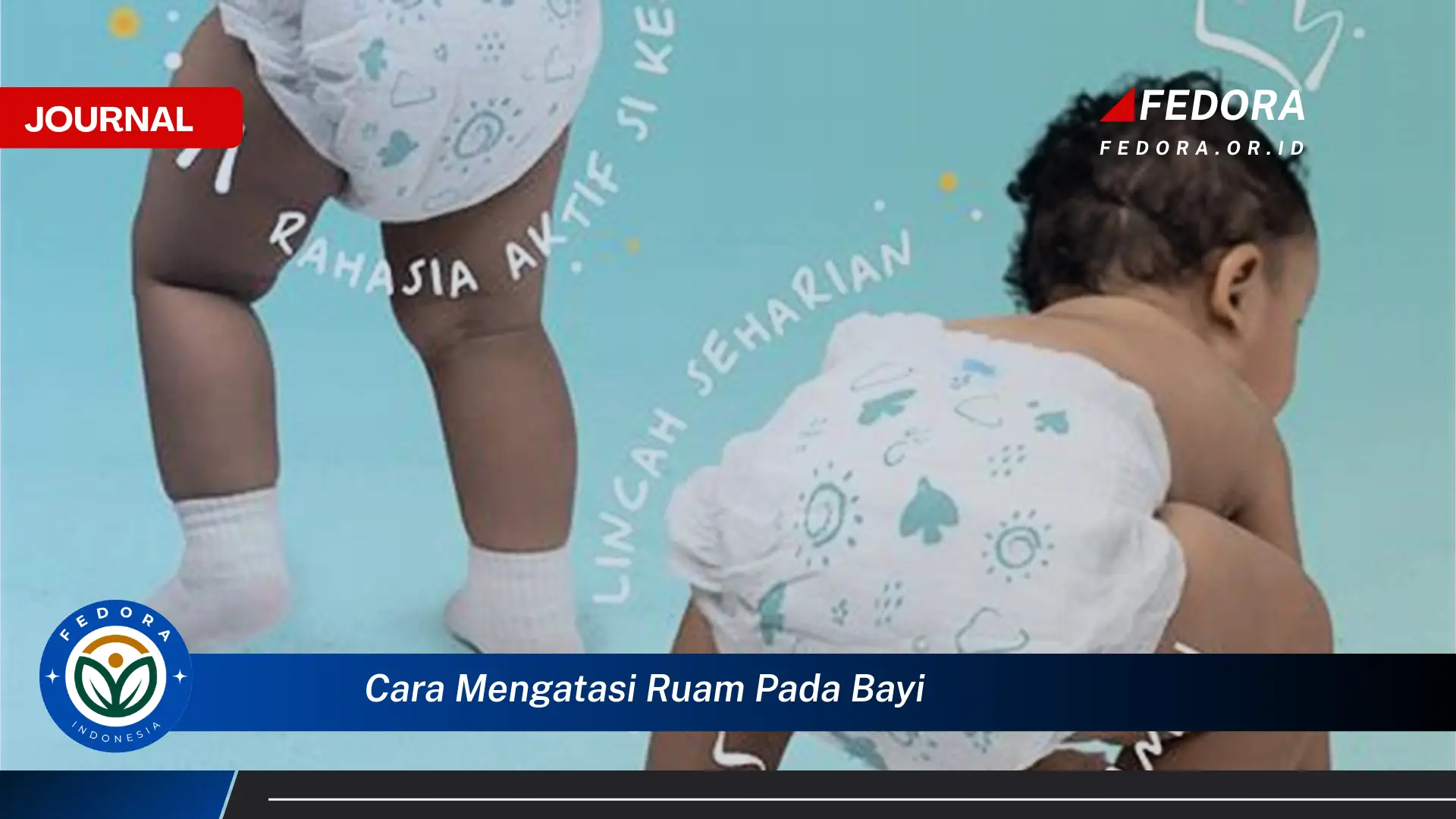 Ketahui Cara Mengatasi Ruam Pada Bayi Dengan Cepat dan Aman Ketahui Cara Mengatasi Ruam Pada Bayi Dengan Cepat dan Aman