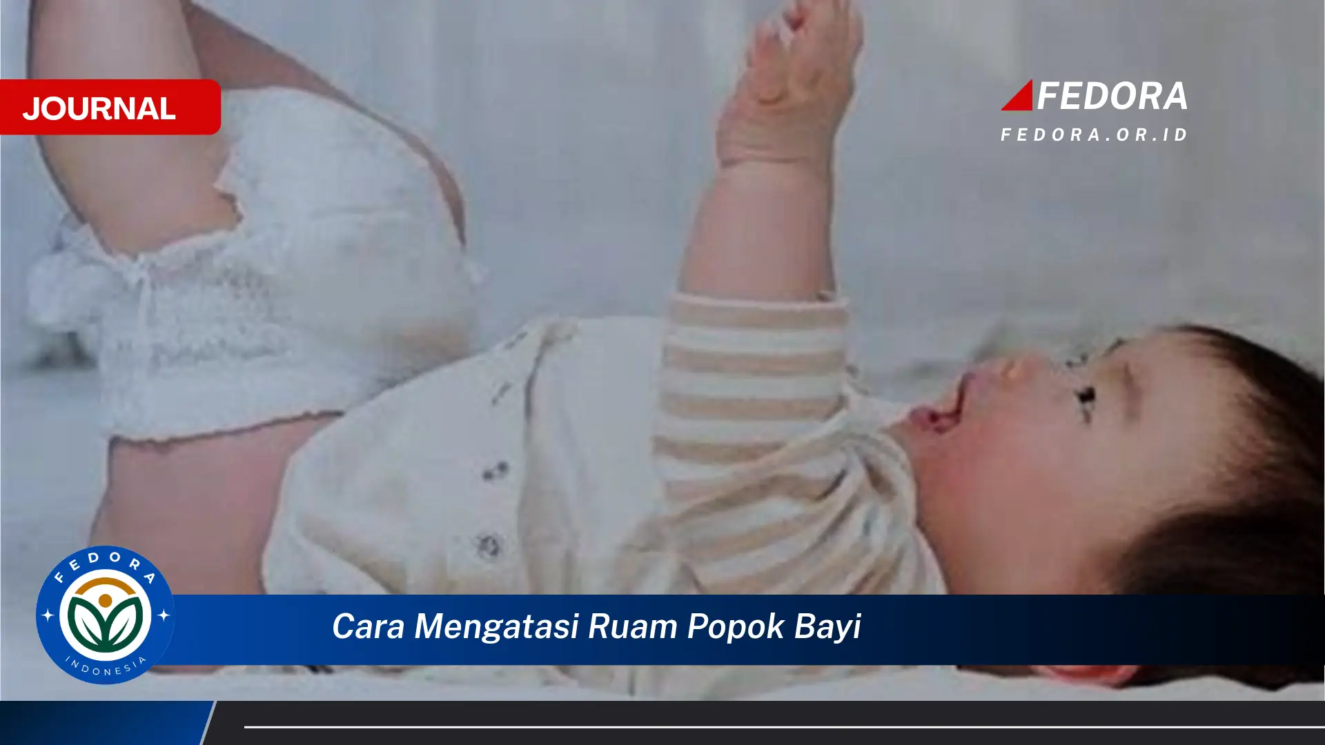 Ketahui Cara Mengatasi Ruam Popok Bayi Secara Alami dan Efektif