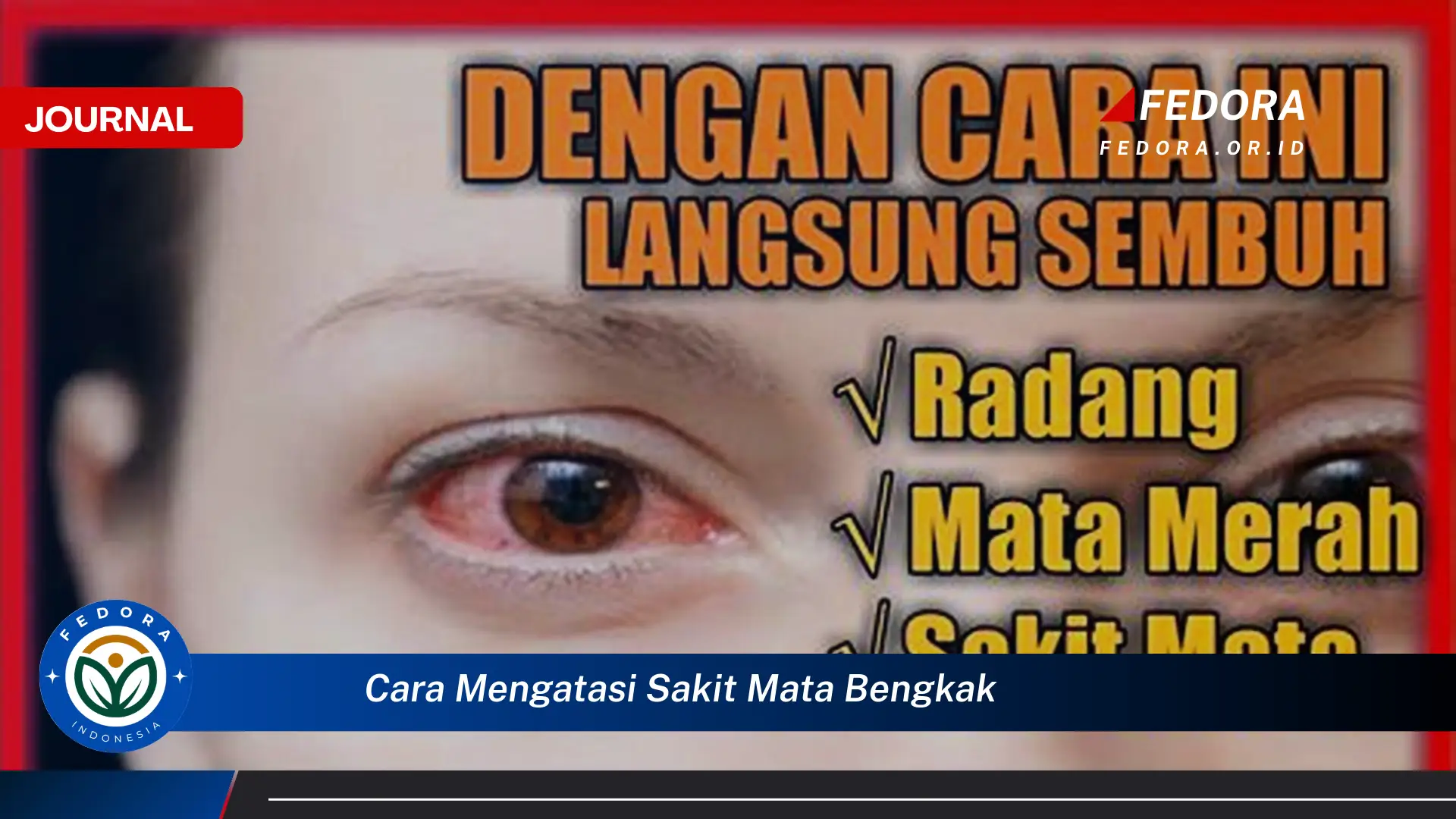 Ketahui Cara Mengatasi Sakit Mata Bengkak dengan Cepat dan Mudah