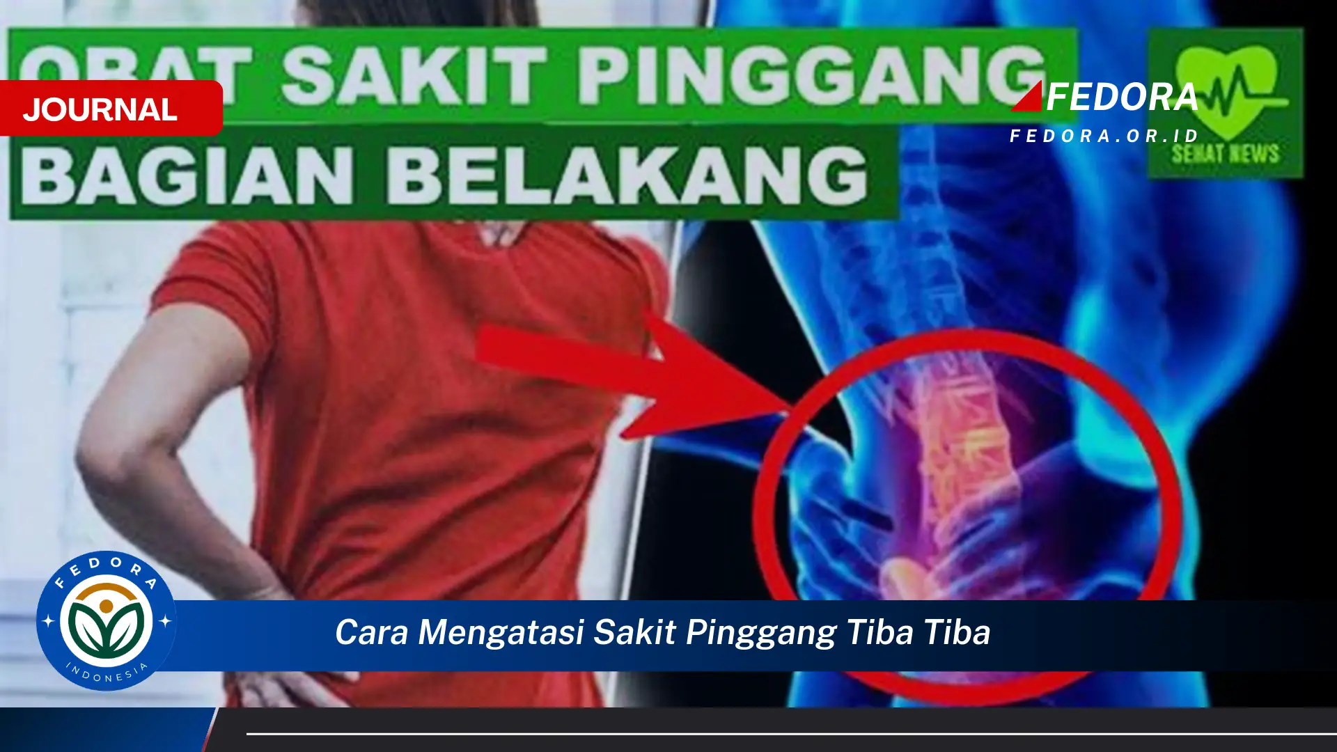 Ketahui Cara Mengatasi Sakit Pinggang Tiba,tiba, Penyebab, Gejala, dan Perawatan di Rumah