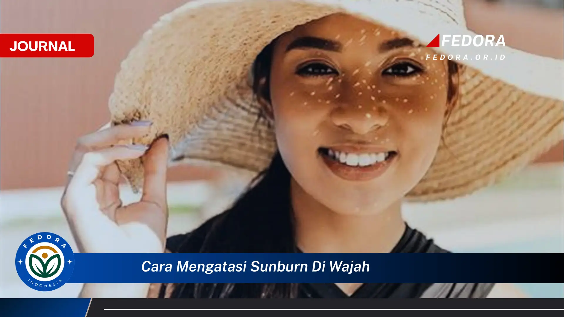 Ketahui Cara Mengatasi Sunburn di Wajah dengan Cepat dan Efektif untuk Kulit Sehat Ketahui Cara Mengatasi Sunburn di Wajah dengan Cepat dan Efektif untuk Kulit Sehat