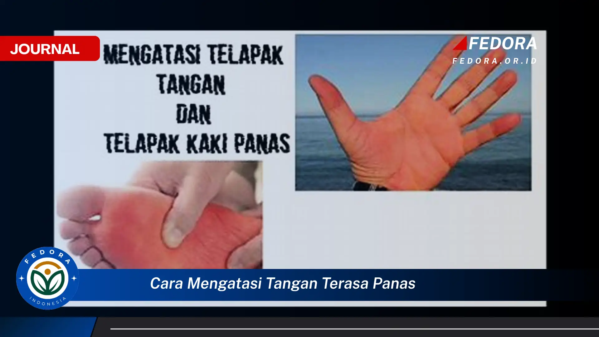 Ketahui Cara Mengatasi Tangan Terasa Panas Secara Alami dan Medis