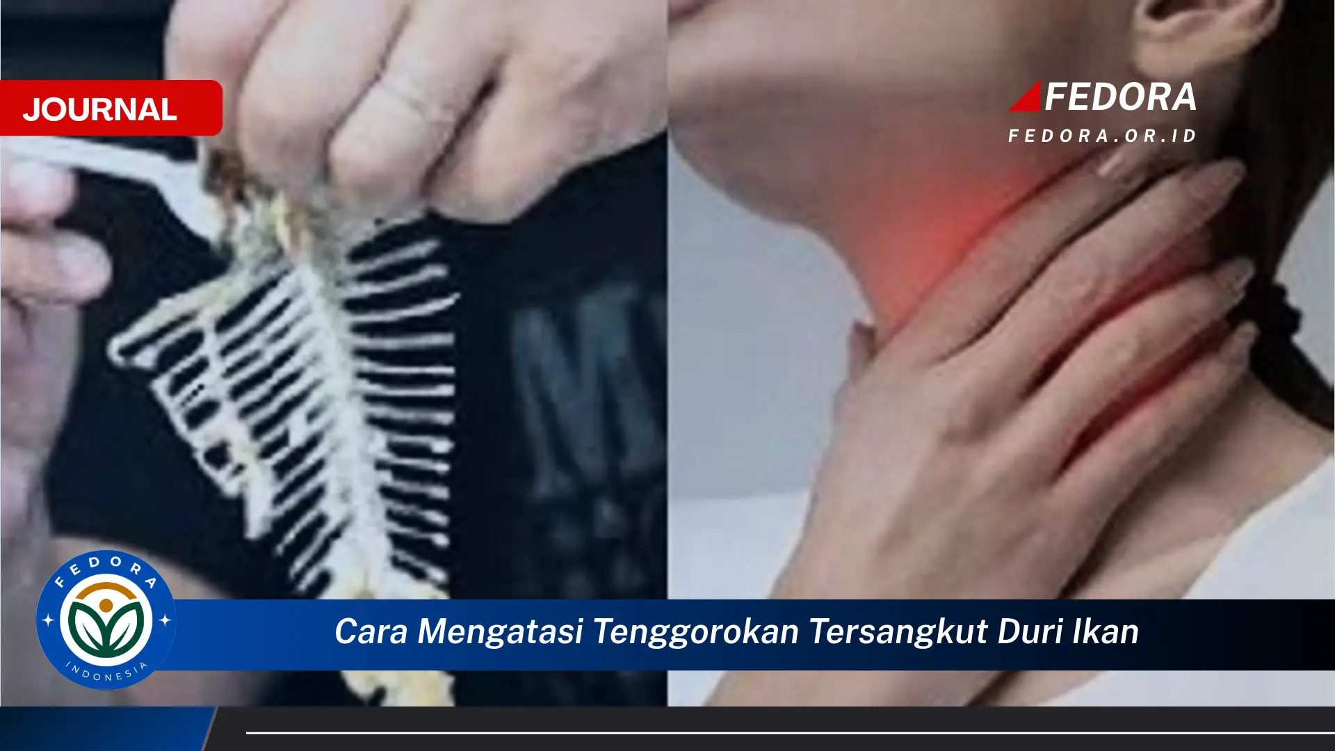Ketahui Cara Mengatasi Tenggorokan Tersangkut Duri Ikan dengan Cepat dan Aman