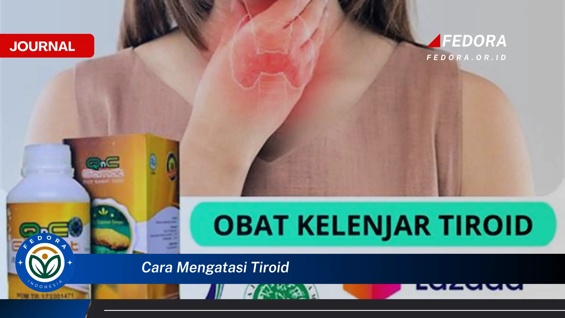 Ketahui Cara Mengatasi Tiroid Secara Alami dan Efektif