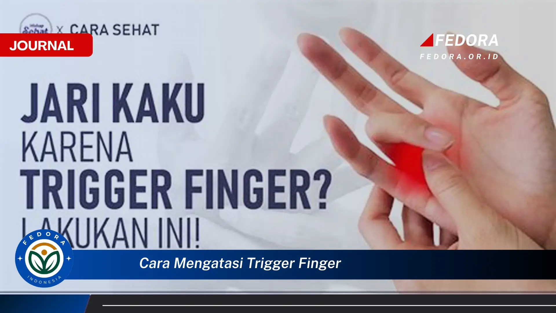 Ketahui Cara Mengatasi Trigger Finger, Panduan Lengkap dan Efektif