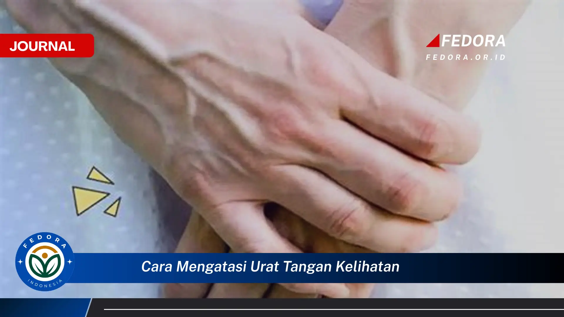 Ketahui Cara Mengatasi Urat Tangan yang Terlihat Menonjol dan Tips Pencegahannya