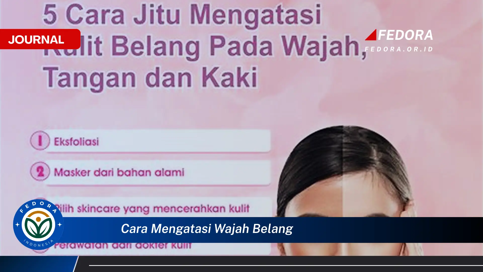 Ketahui Cara Mengatasi Wajah Belang Secara Cepat dan Efektif