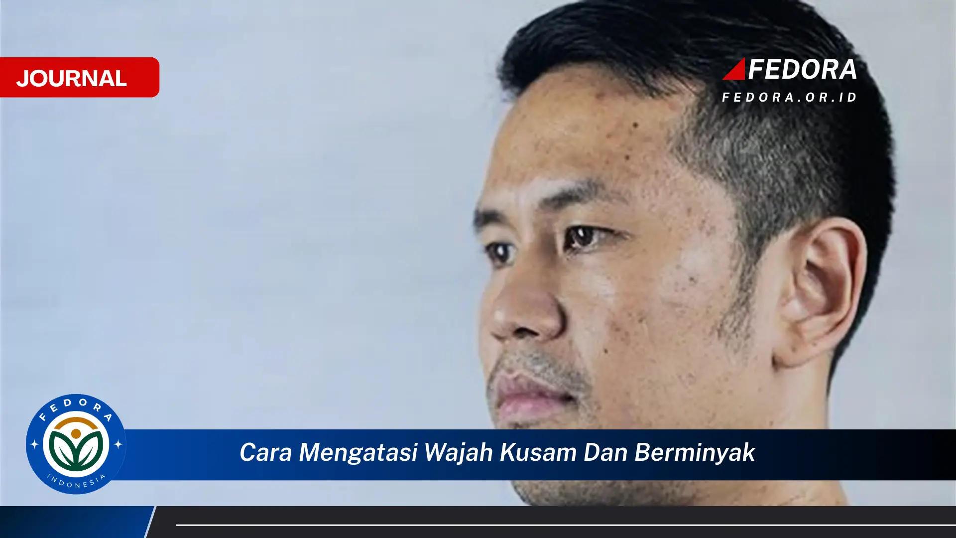 Temukan Cara Mengatasi Wajah Kusam dan Berminyak untuk Kulit Sehat Bersinar