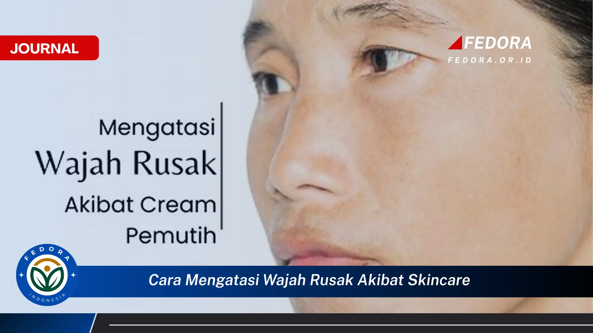 Temukan Cara Mengatasi Wajah Rusak Akibat Skincare dan Mengembalikan Kulit Sehatmu